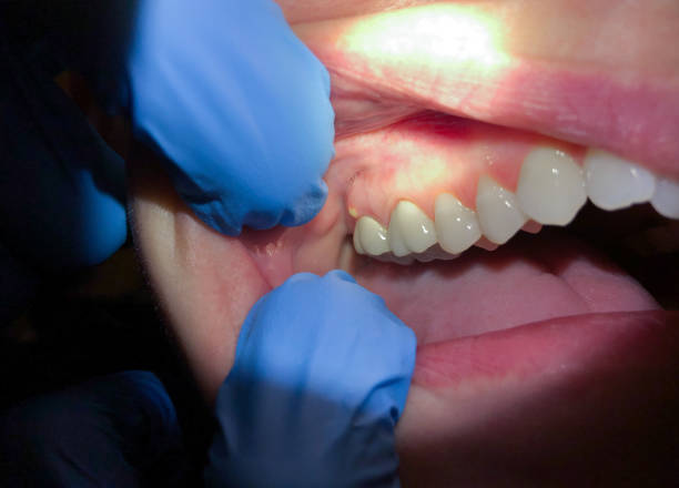 Best Broken or Cracked Tooth Emergency Dentist in Franklin Rk, PA